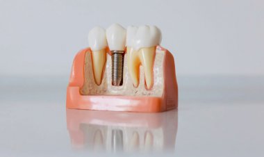 Ontario Dental and Denture Benefits for Seniors